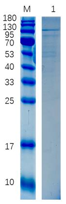 12% reducing SDS-PAGE analysis of purified TBK1.